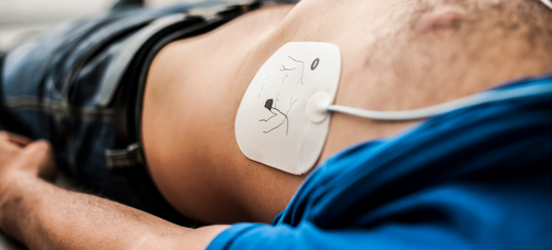 Semi-Automatic vs Fully Automatic Defibrillators